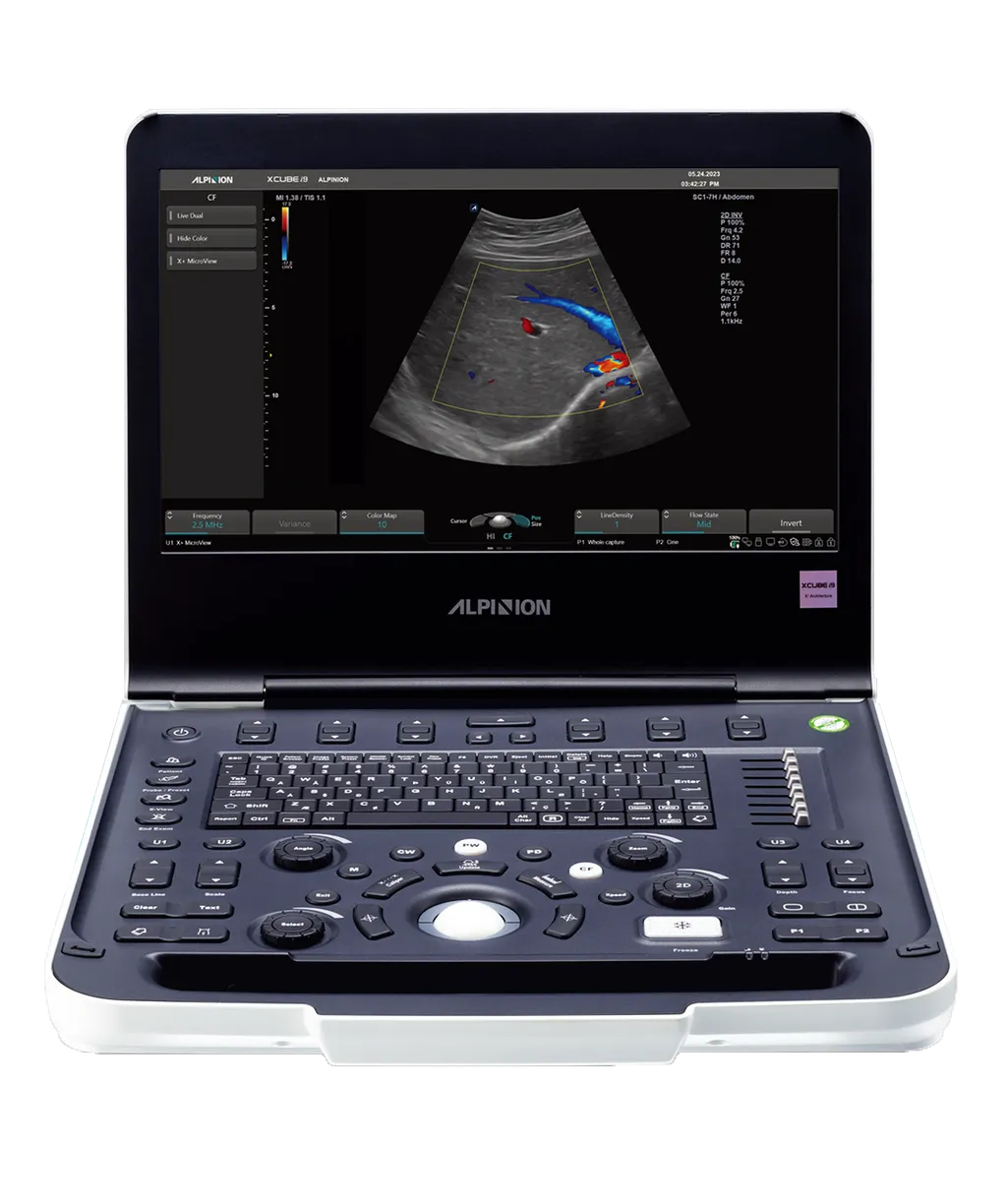Alpinion XCUBE i9