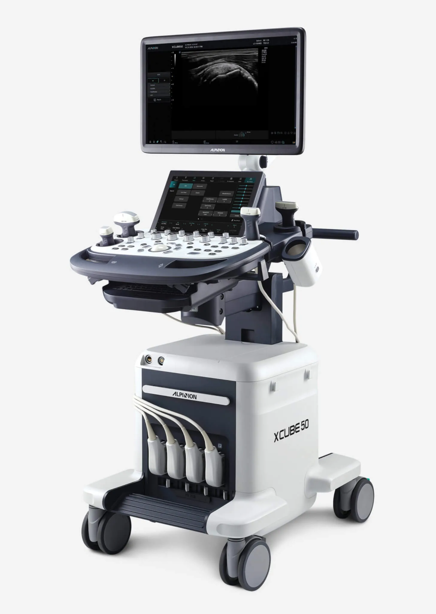 Aparat USG Alpinion X-Cube 50 Elite na mobilnym wózku